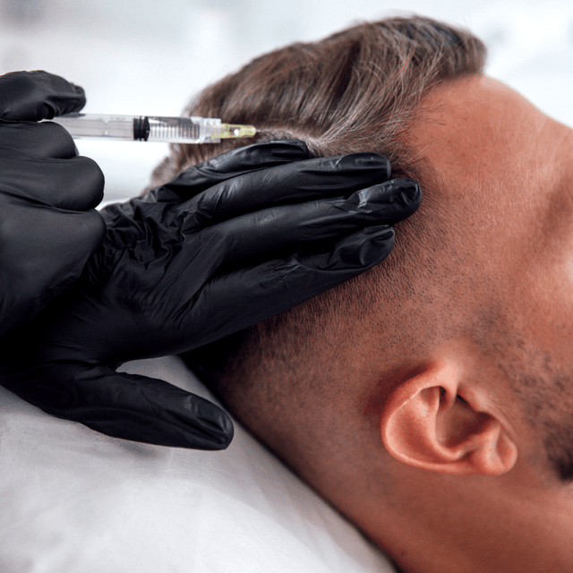 Hair Restoration at Cherlyn Deleonabreu “Perfectly You” in Liverpool, NY